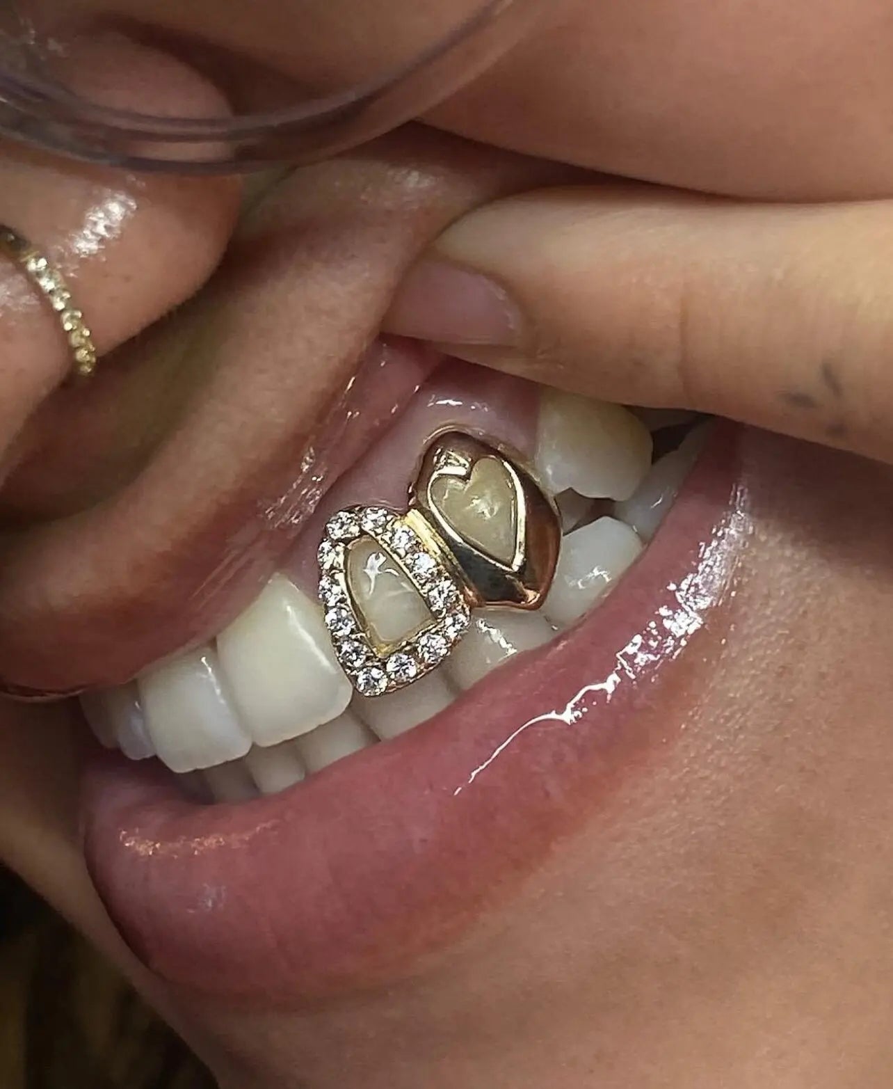 Fluxe Grillz Hollywood Grillz