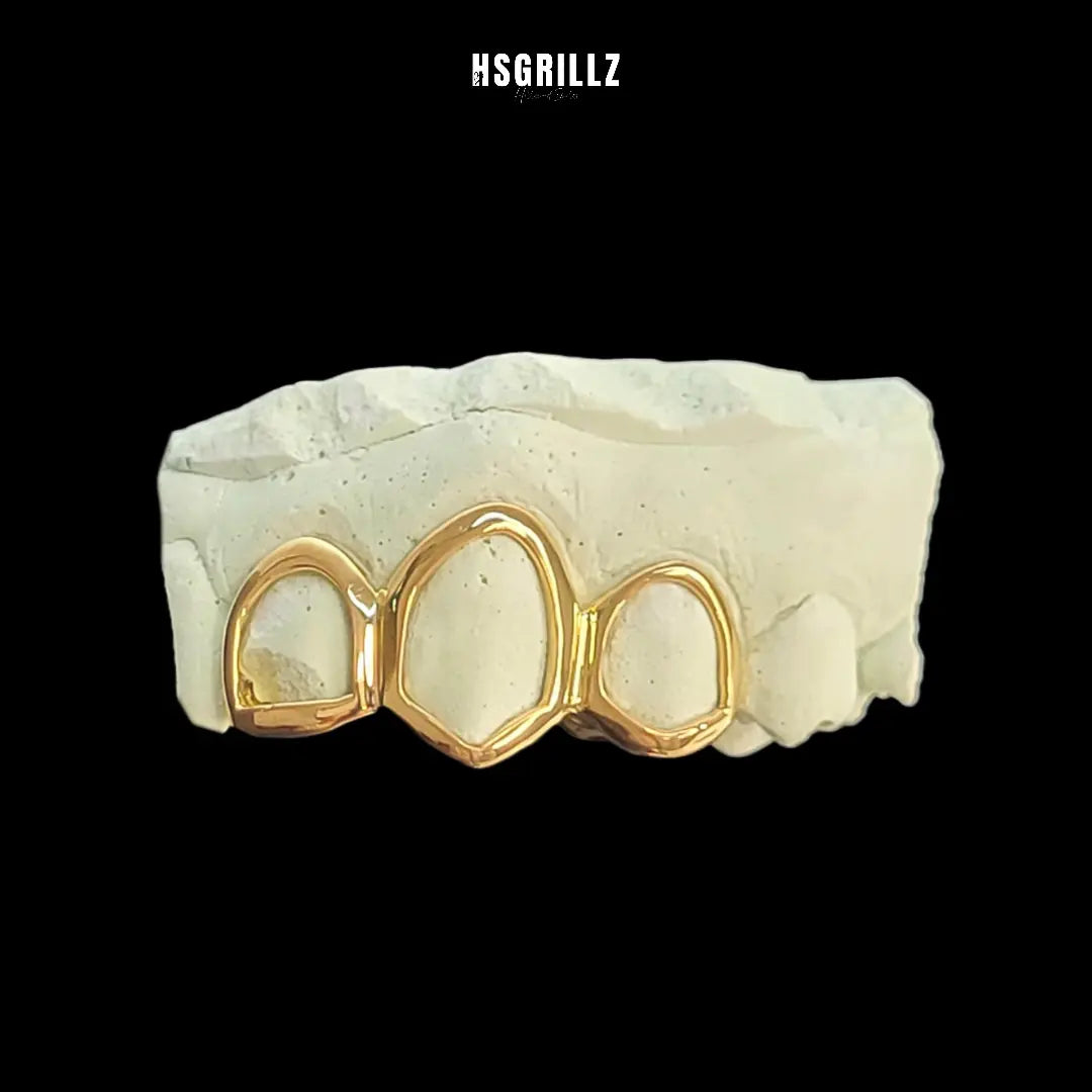 Zolara Custom Gold Grillz Hollywood Grillz