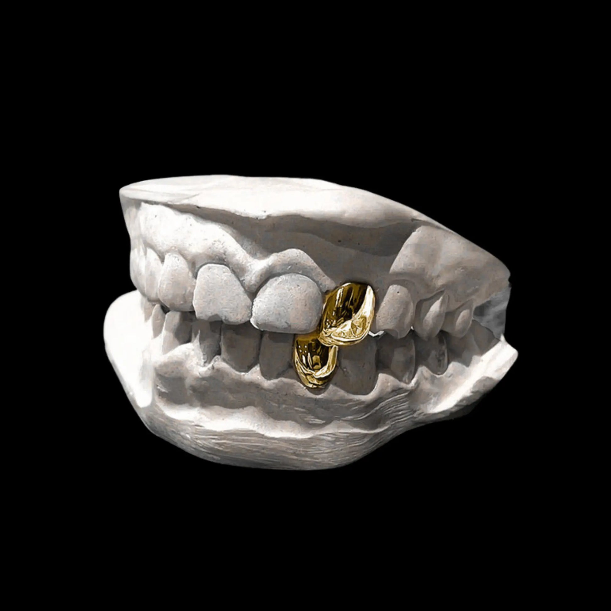 Echo Grillz Hollywood Grillz