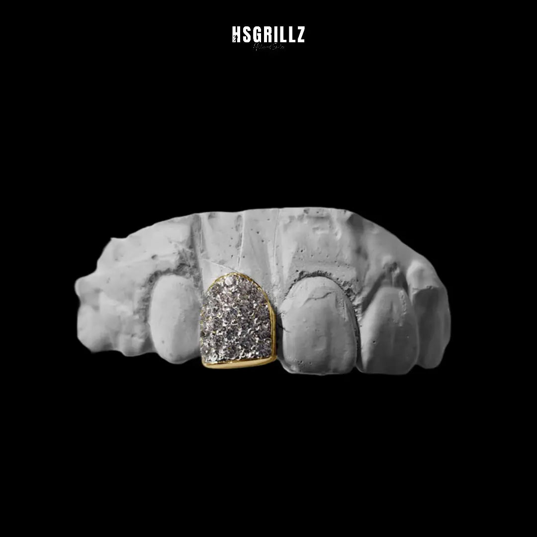 FROST (GOLD GRILLZ) Hollywood Grillz
